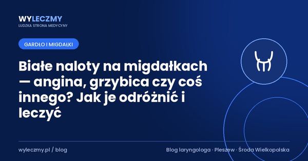 Białe naloty na migdałkach — angina, grzybica czy coś innego? Jak je odróżnić i leczyć