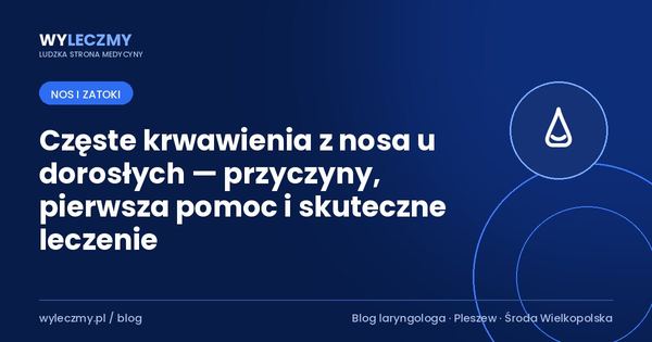 Częste krwawienia z nosa u dorosłych — przyczyny, pierwsza pomoc i skuteczne leczenie
